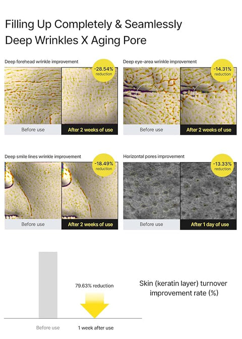 A Retinal Shot Tightening Booster